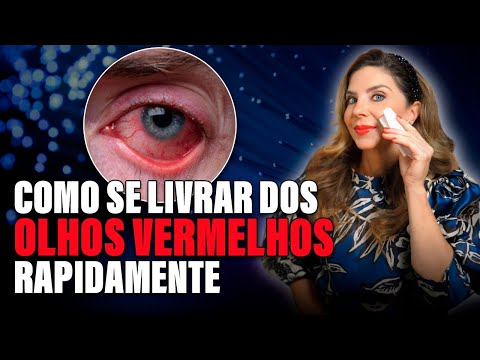 Como Se Livrar dos Olhos Vermelhos Rapidamente