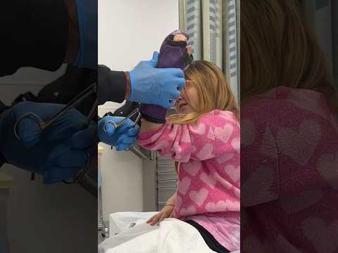 STINKY Fingers 🤮 #funny #vlog