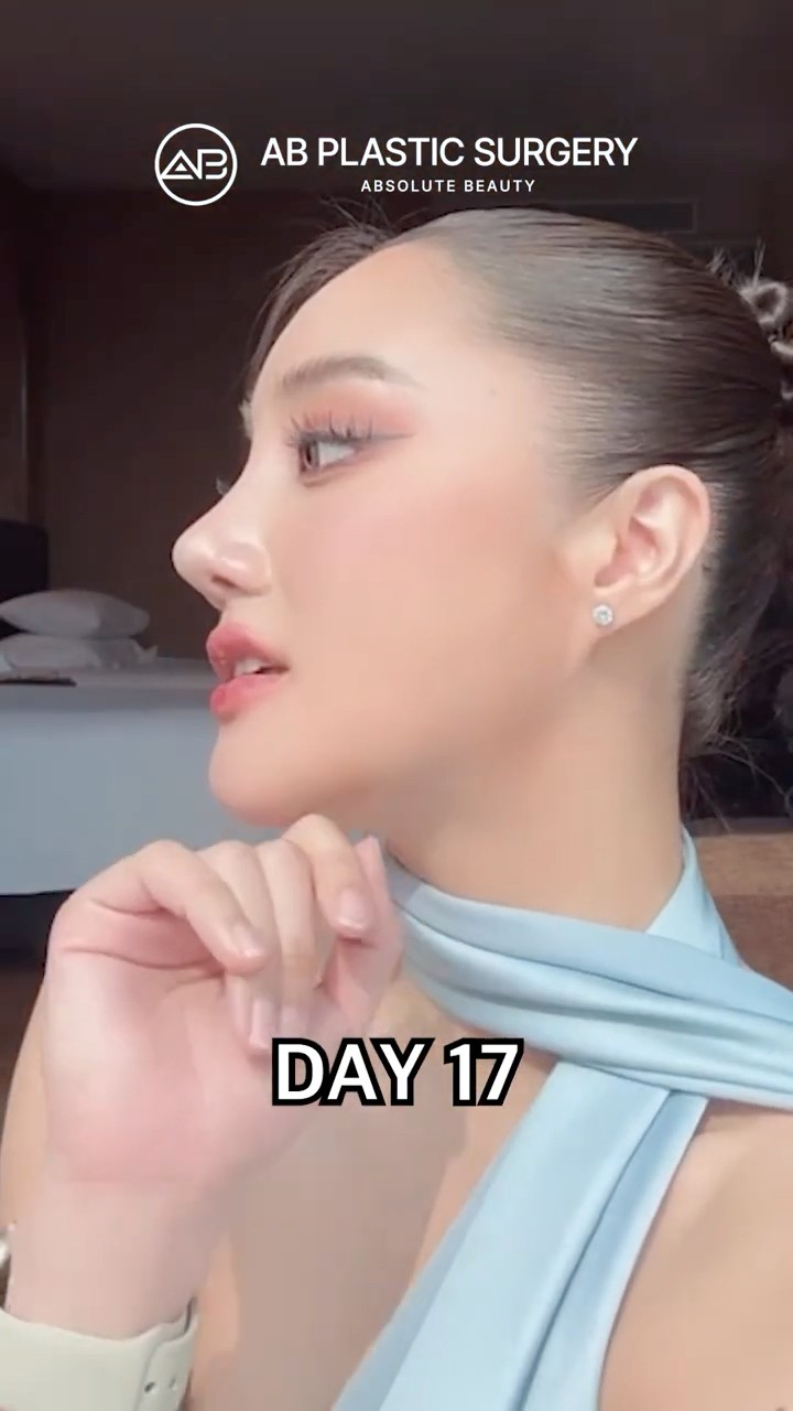 Barbie Nose Gone Wrong? Her Revision Reveal