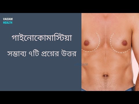 বর্ধিত পুরুষ স্তন ৭ টি প্রায়শই জিজ্ঞাসিত প্রশ্নাবলী (গাইনোকোমাস্টিয়া)