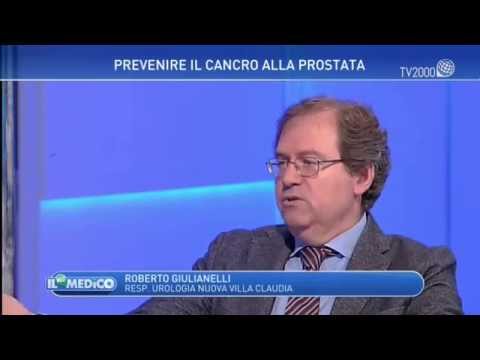 Professore di trattamento della prostatite Di fibrosi della prostata trattare