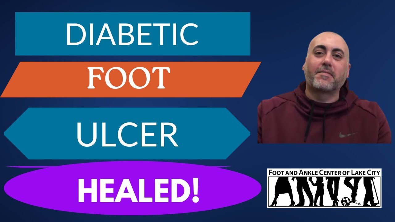 Patient Testimonial - Diabetic Foot Ulcer 