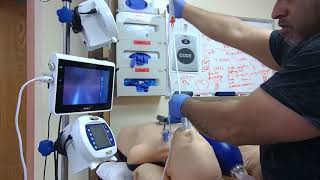 Ambu Ascope used to intubate via the Air-Q intubating Supraglottic Airway