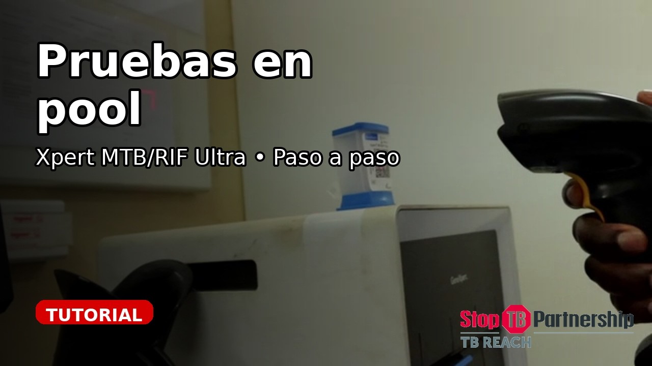 Cómo realizar pruebas en pool para TB