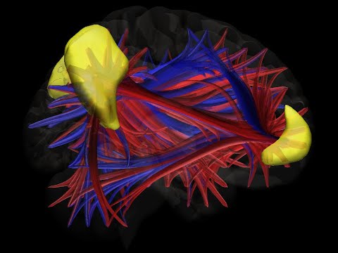 Functional connectivity of the Default Mode Network (DMN)