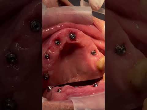 video 4MNBoThOEF8