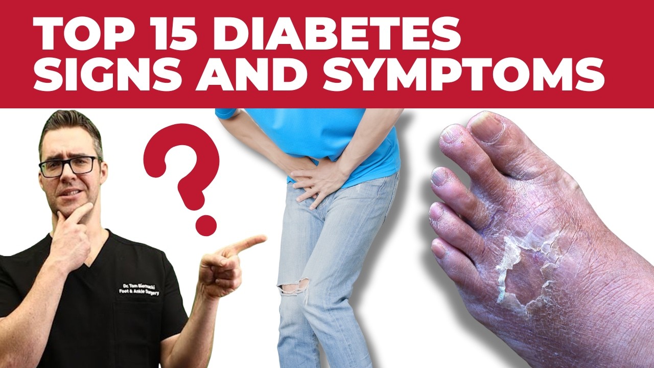 TOP 15 Diabetes Skin Signs & Symptoms [Type 2 & 1 Diabetes Mellitus]