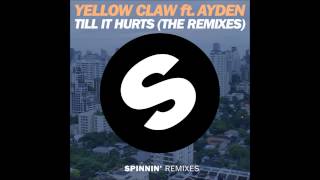 Yellow Claw ft. Ayden - Till It Hurts (Mr. Belt &amp; Wezol Remix)