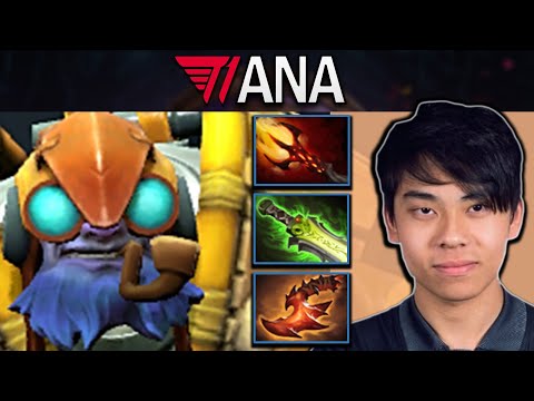 Tinker Dota 2 Gameplay T1.Ana with 25 Kills - Scythe of Vyse - TI12