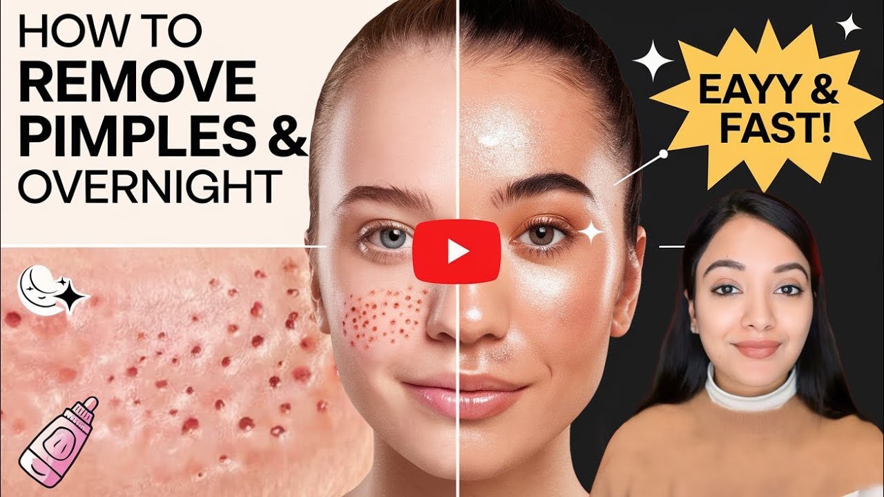Over night pimple treatment
