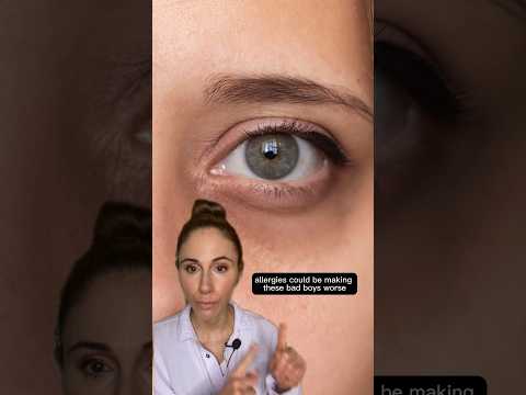 How To Get Rid Of Dark Circles Under Your Eyes #dermatologist