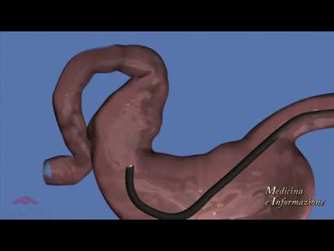 Porno con un pene piccolo Compresse per potenza nel diabete mellito di tipo 2