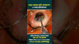 দেখুন চোখের ছানি অপারেশন ও লেন্স প্রতিস্থাপন!!