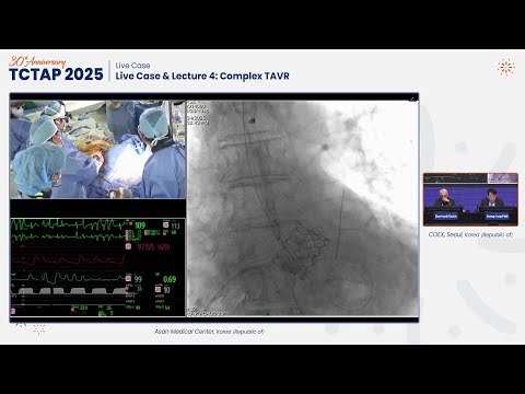 [TCTAP 2025] Live Case & Lecture 4: Complex TAVR