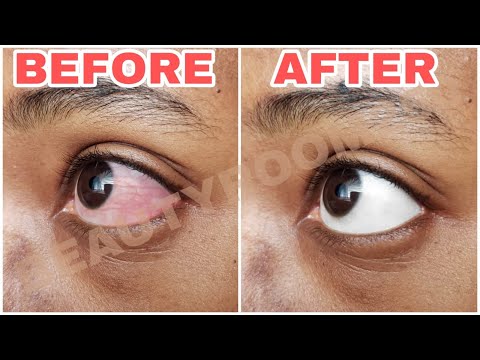 UKO WAGIRA AMASO YUMWERU | UBURYO 10 BWO KUGIRA AMASO YUMWERU | BEAUTYROOM250