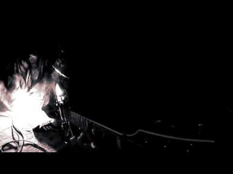 DISPHEXIA   Aberrant Congenital Malformation