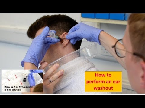 How to Perform an Ear Washout (irrigation) - ENT/Otolaryngology Skills
