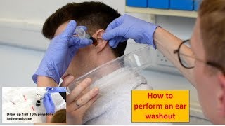 How to Perform an Ear Washout (irrigation) - ENT/Otolaryngology Skills