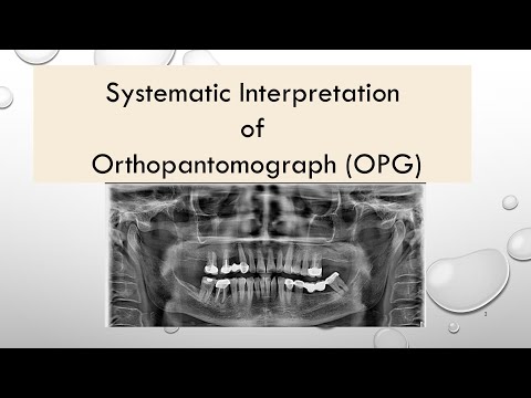 Systematic Interpretation of Orthopantomograph (OPG)