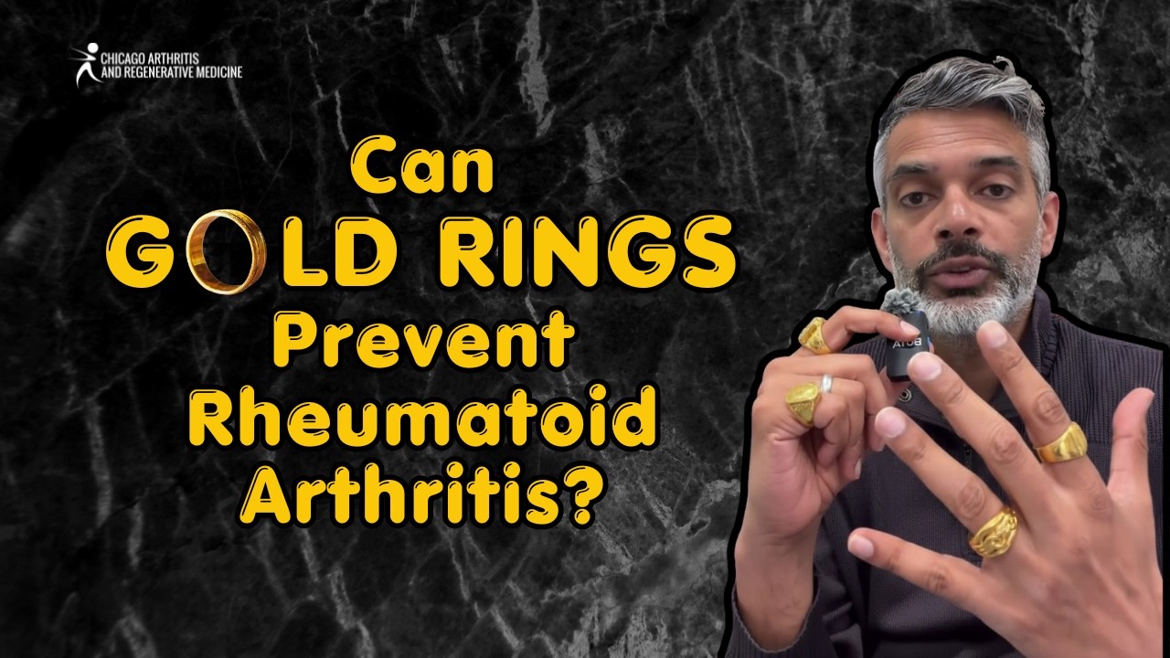 Can Gold Rings Prevent Rheumatoid Arthritis? img