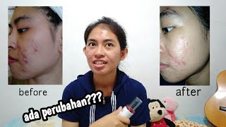 Download lagu SETELAH 2 BULAN, GIMANA HASILNYA ? TIPS MENGGUNAKAN SERUM SNAIL TRUECICA mp3