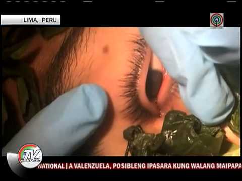 Kung paano mangayayat wrap na may kumapit film Tulad ng pagkuha ng Brewer ng lebadura diyeta