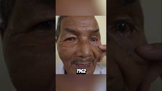 People With The Rarest Medical Conditions
