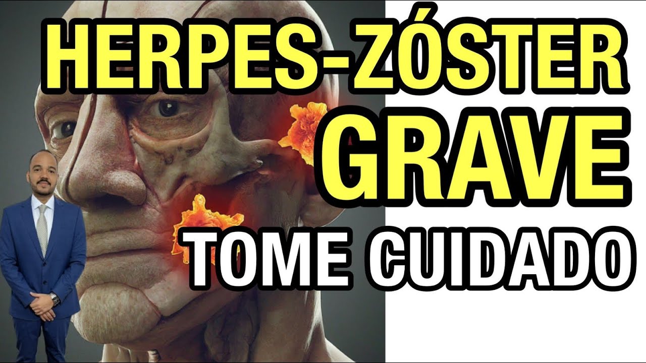 Herpes-zóster: saiba mais sobre sua prevenção e tratamento