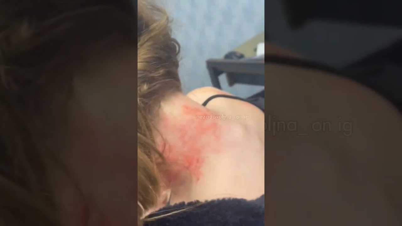 Strašno! Sestra od Uki q brutalno pretučena od strane svog muža