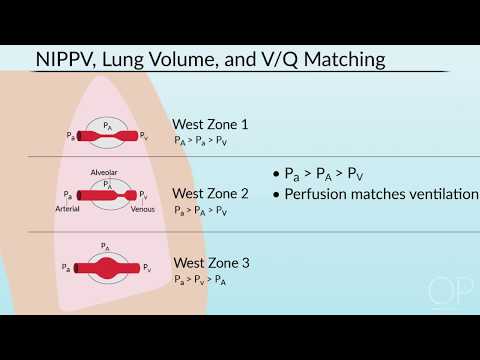 Pulmonary Mechanics in Non-Invasive Positive Pressure Ventilation by B. McAlvin | OPENPediatrics
