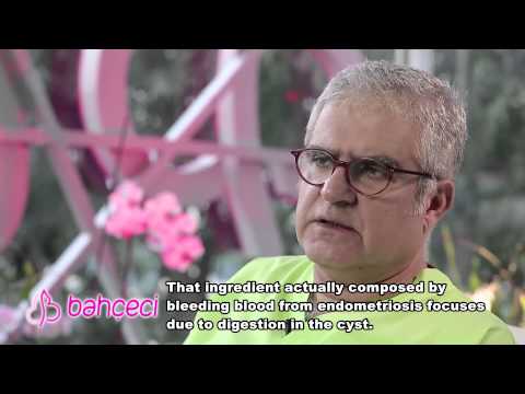 What does chocolate cyst refers to? How is it diagnosed?