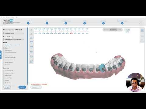 DIBS AI #1: Case set up tutorial, smile show, bolton, occlusion, cbct root integration, class III