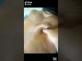 Pijat Tulungagung Siap Datang Wa Kami 082245841245