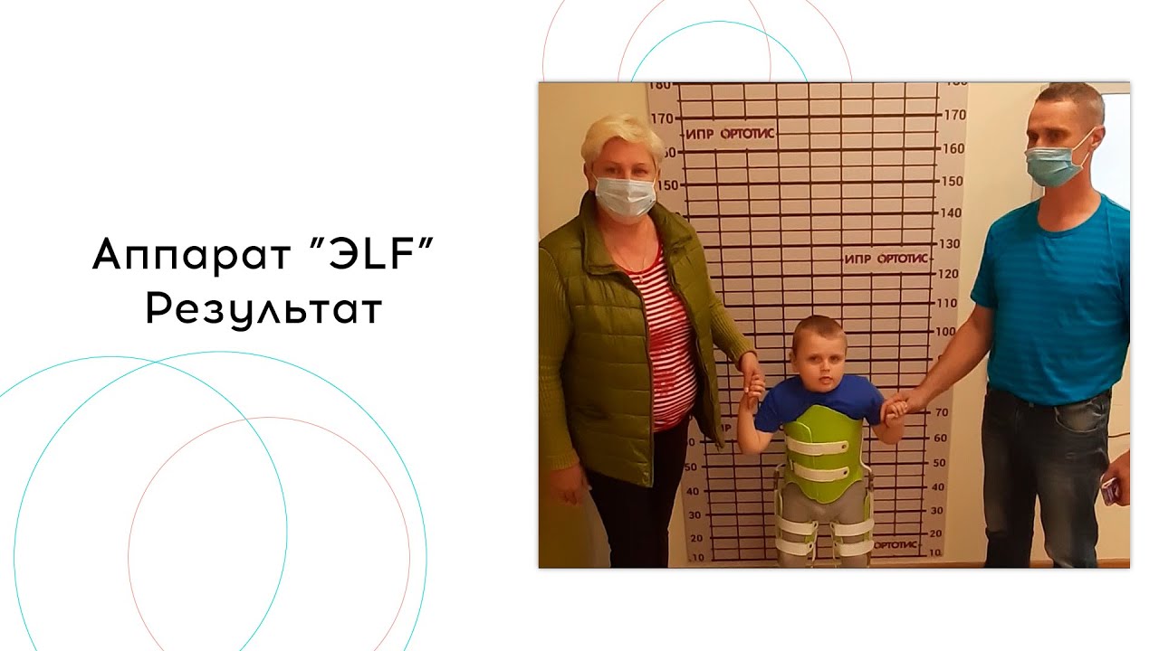 Аппарат ЭLF - Ортотис Премиум