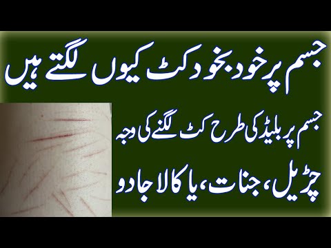 Jisam Par Khud Ba Khud Kat Lagna |Kala Jadu Or Jinnat Se Jisam Par Kat Lagay Jana|Roohani Shagird