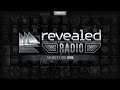 Revealed Radio 021 - Hosted by Dyro 
