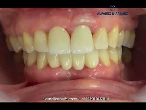 video 4OMgGlfVakc