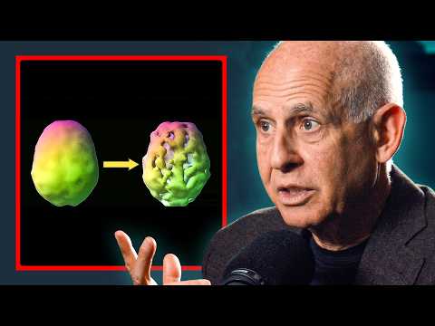 @ChrisWillx - "This Is What Alcohol & Marijuana Do To Your Brain - Dr Daniel Amen"