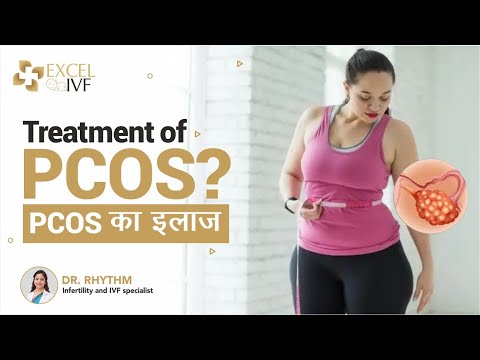 Treatment of PCOS | PCOS का इलाज | Dr Rhythm Gupta - Infertility and IVF Specialist in Delhi