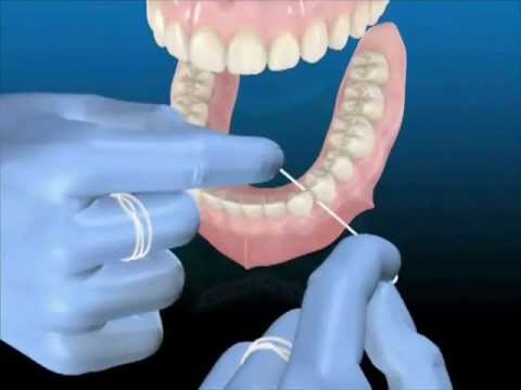 download lagu mp3 mp4 Filo Interdentale, download lagu Filo Interdentale gratis, unduh video klip Filo Interdentale