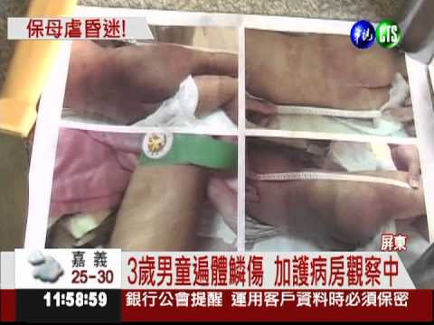 管教變虐待! 保母痛揍3歲男童