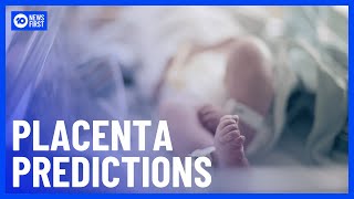 AI Tool Set To Predict Health Issues With Picture Of The Placenta| 10 News First