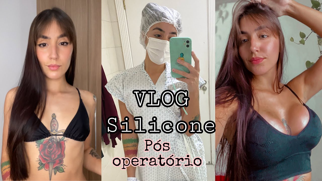 Watch Now Meu silicone #2: VLOG • O GRANDE DIA, MEU PÓS OPERATÓRIO E RETORNO Meu silicone #2: VLOG • O GRANDE DIA, MEU PÓS OPERATÓRIO E RETORNO