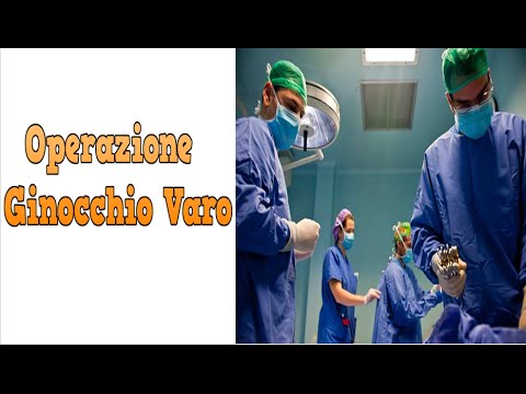 Massaggio del bambino con il video displasia dellanca Hip rapitore