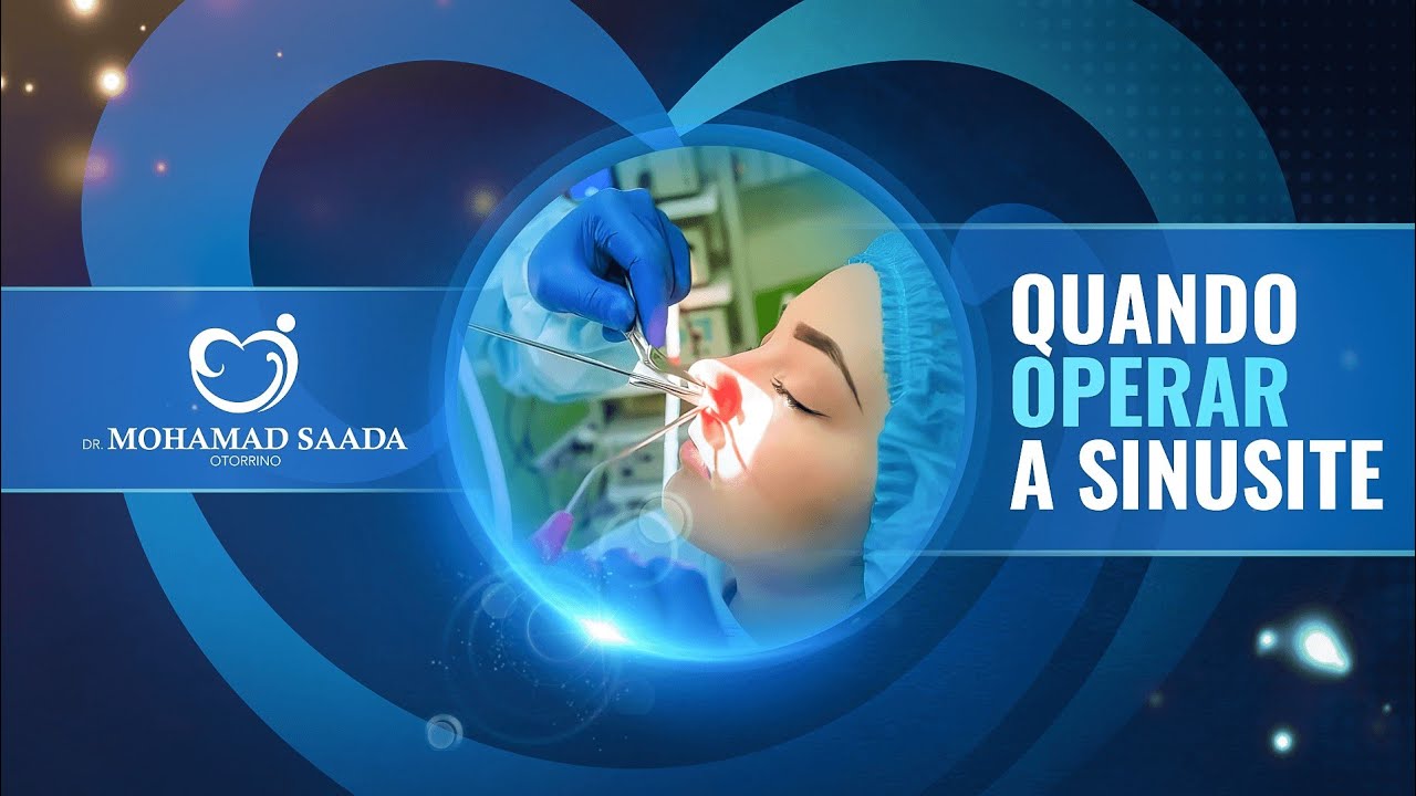 QUANDO OPERAR A SINUSITE?