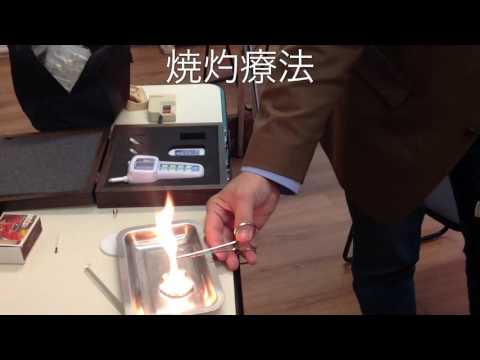 耳介療法 - 定義