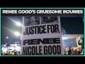 Renee Good S BRUTAL Injuries From Shooting Revealed