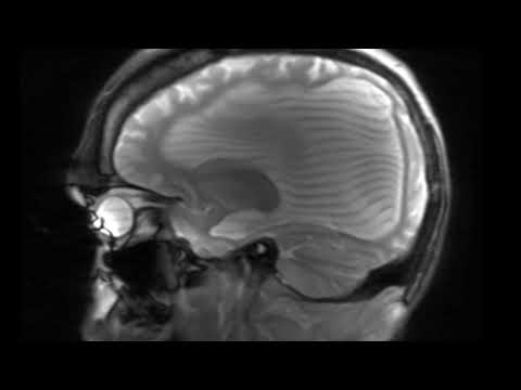 How To Escape: Never Knowing (Clip)