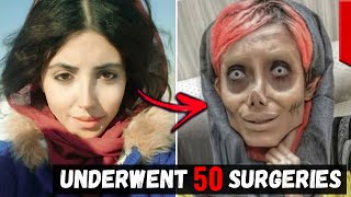 10 People Who Took Plastic Surgery Too Far...