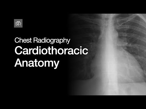 Chest Radiography: Cardiothoracic Anatomy